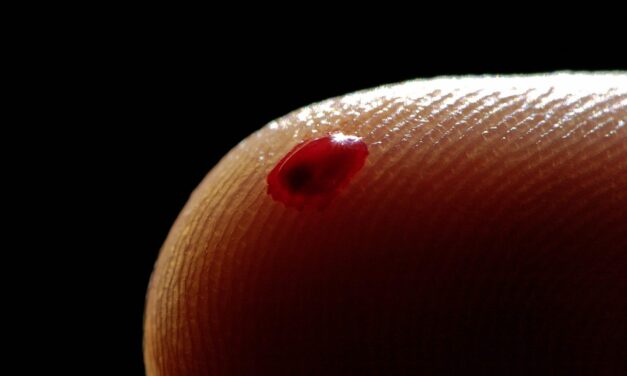 Minimally Invasive Blood Sampling: Innovations and Impacts on Patient Care